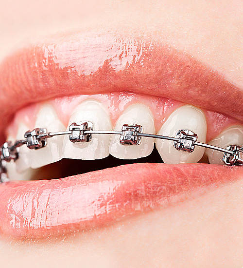 Cosmetic Dentistry