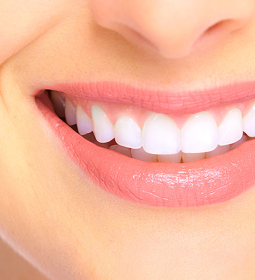 Crowns & Veneers